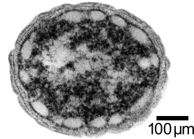 Chlorobium Tepidum Transmission Micrograph Image